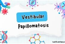 Vestibular Papillomatosis: Causes, Symptoms, and How It Differs From Genital Warts Vestibular Papillomatosis