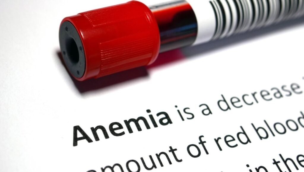 sickle cell anemia symptoms in women